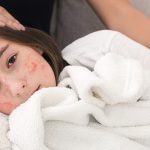 Anak Terkena Campak, Bolehkah Beraktivitas Di Luar?