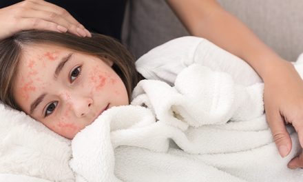 Anak Terkena Campak, Bolehkah Beraktivitas Di Luar?